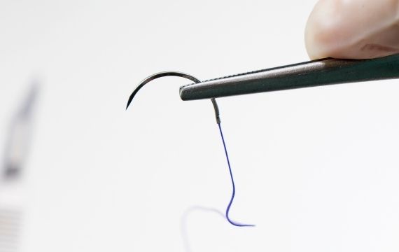 Your Trusted Polyglycolic Acid Suture Supplier1