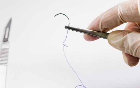 Your Trusted Polyglycolic Acid Suture Supplier