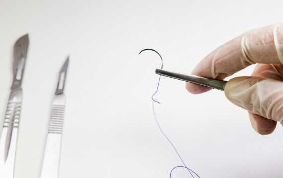 Medico – Leading Prolene Suture Supplier in China