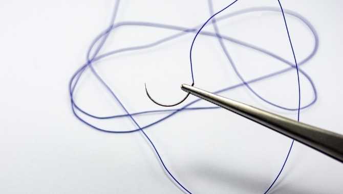 Prolene Suture Advantages