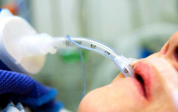 Medico Professional Endobronchial Tube Manufacturer