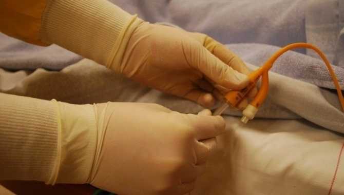 Medico – Leading Foley Catheter Supplier in China (1)