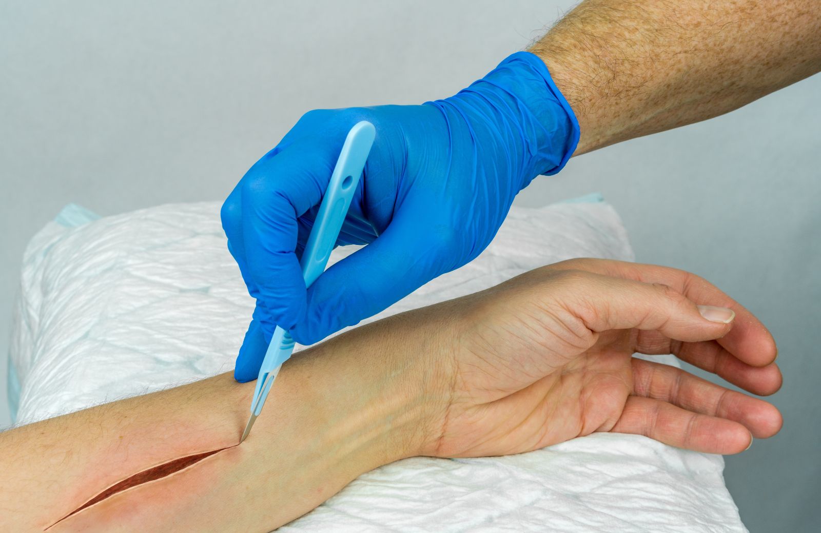 Surgical Scalpel Accuracy