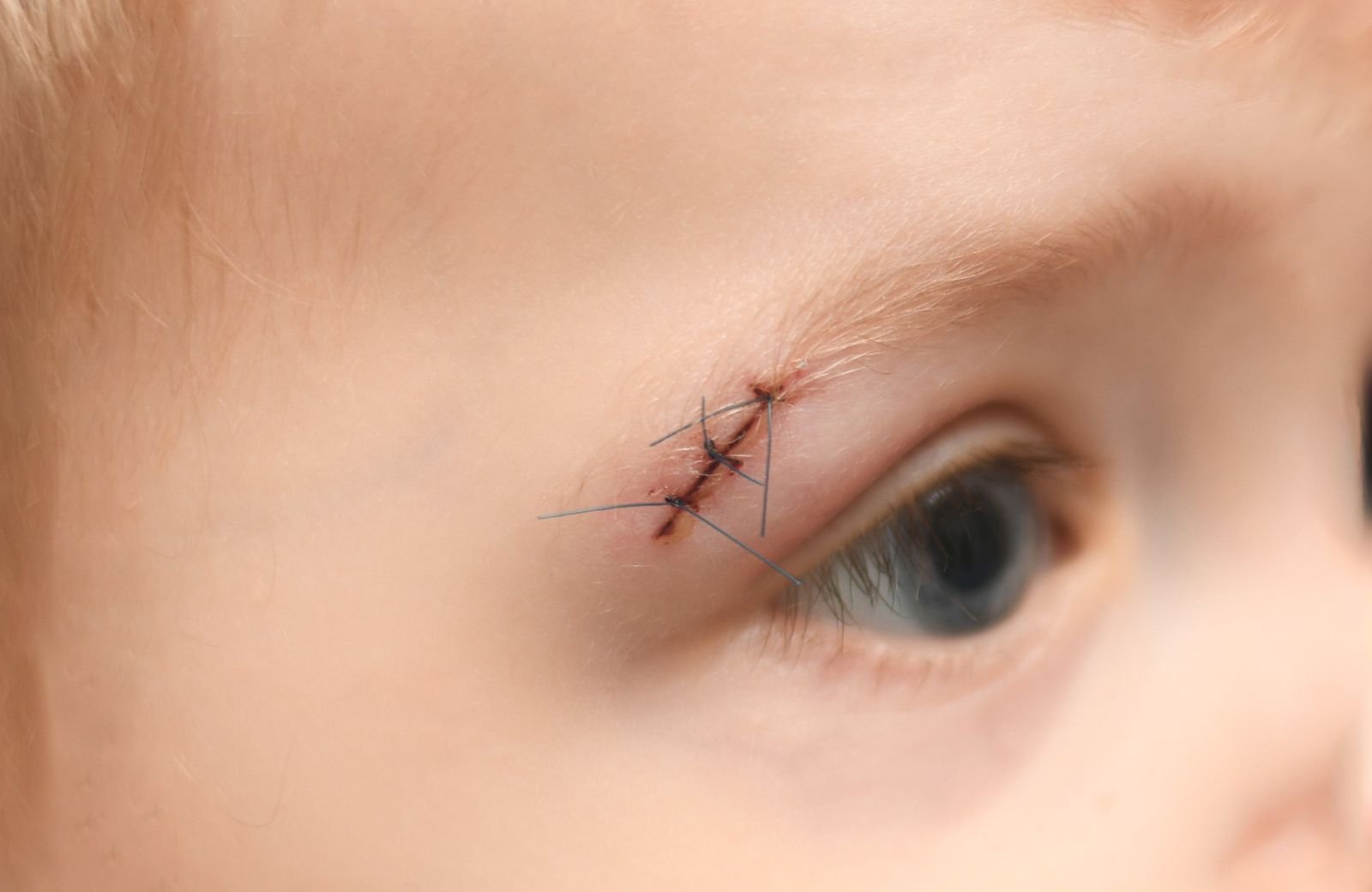 Caring for Blue Stitches
