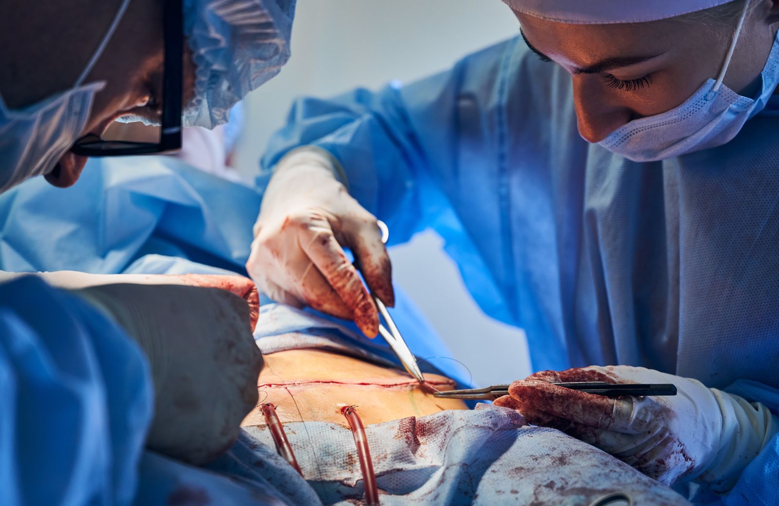 Applying Blanket Sutures